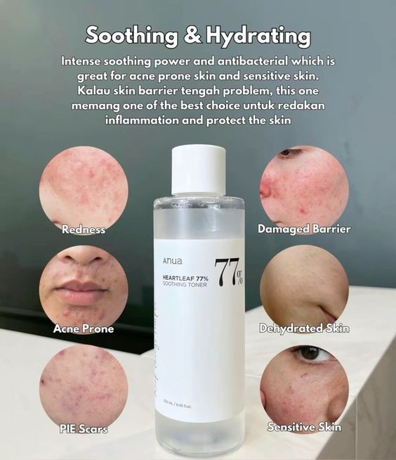 Anua Heartleaf 77% soothing toner + 1 FREE daily lotion Limited time bundle.